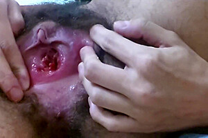 Ftm Stretches Pussy With Big Bottle And Gape And Prolapse