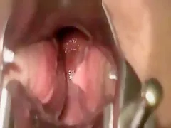 Cervix Cunt Contractions While Rubing Clit